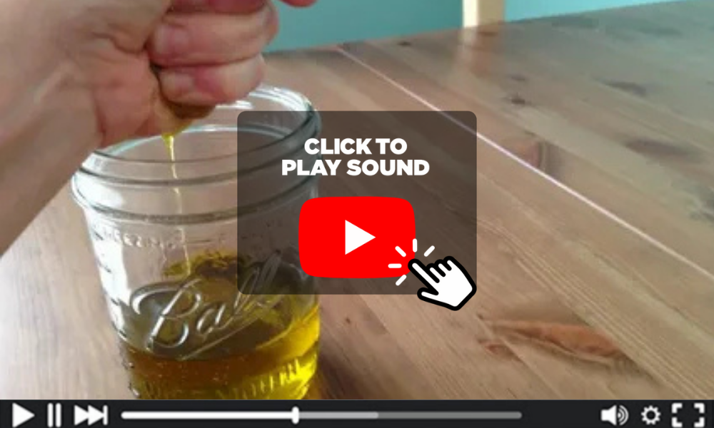 Watch blood sugar presentation